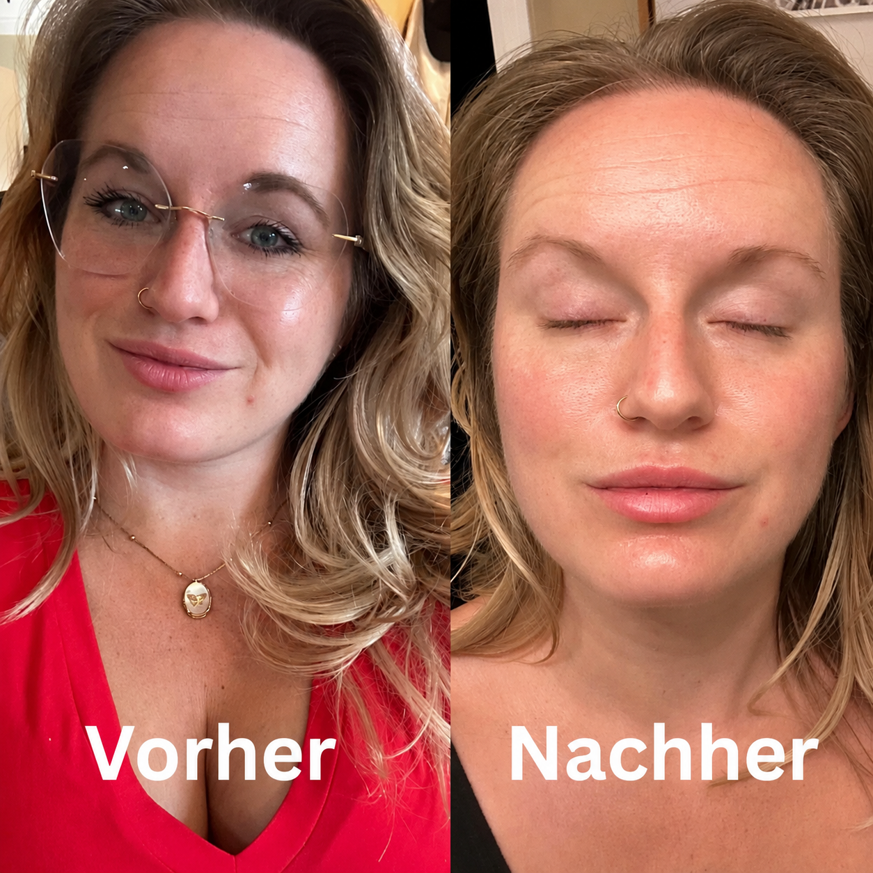 Kollagen Boosting Maske