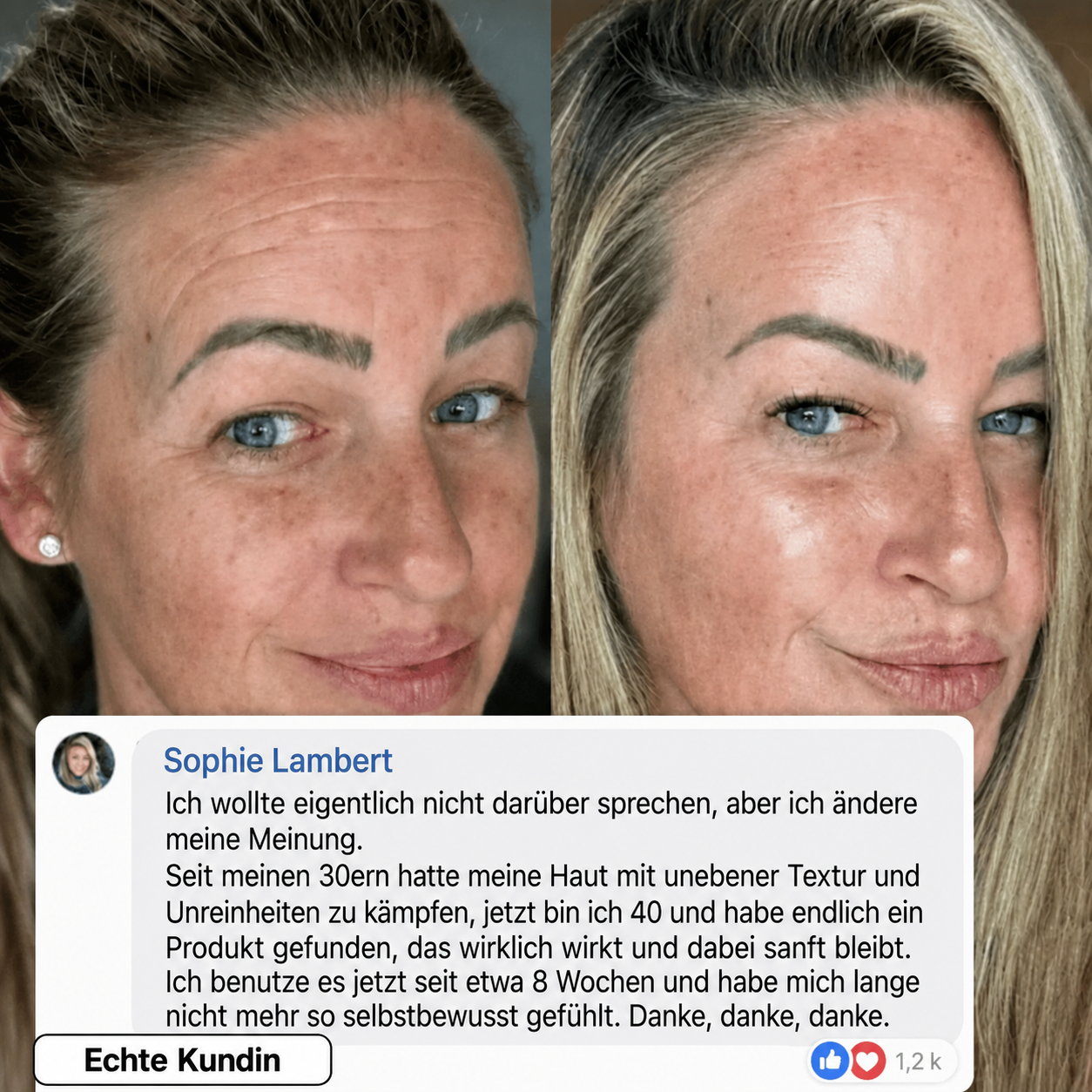 Bio-Kollagen PDRN Aufpolsternder Stick