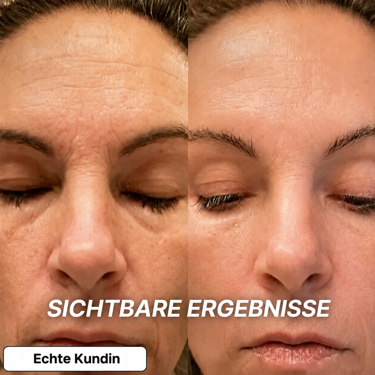Bio-Kollagen PDRN Aufpolsternder Stick