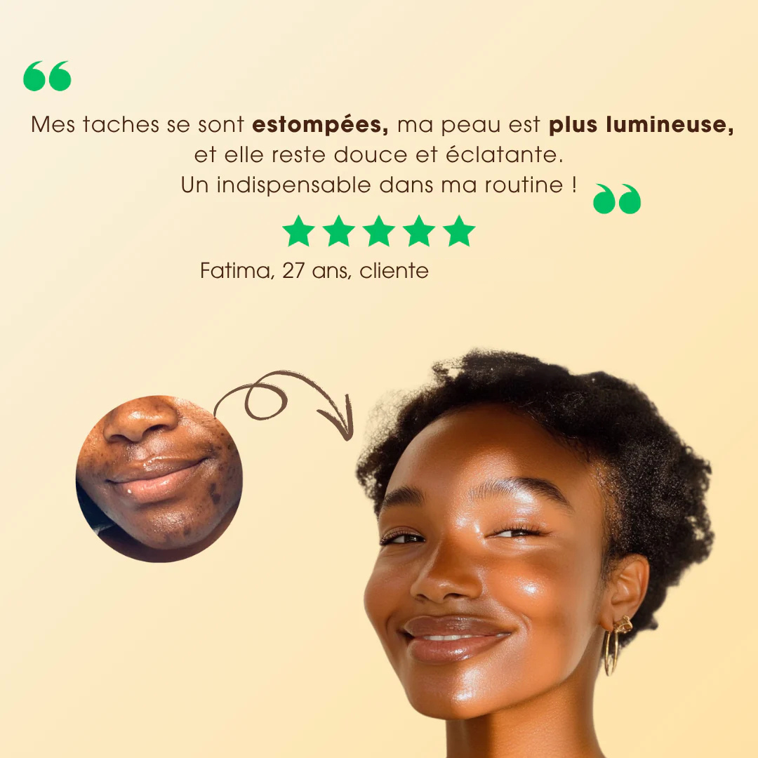 Savon Anti-Taches & Hyperpigmentation au Curcuma (+200g OFFERTS)