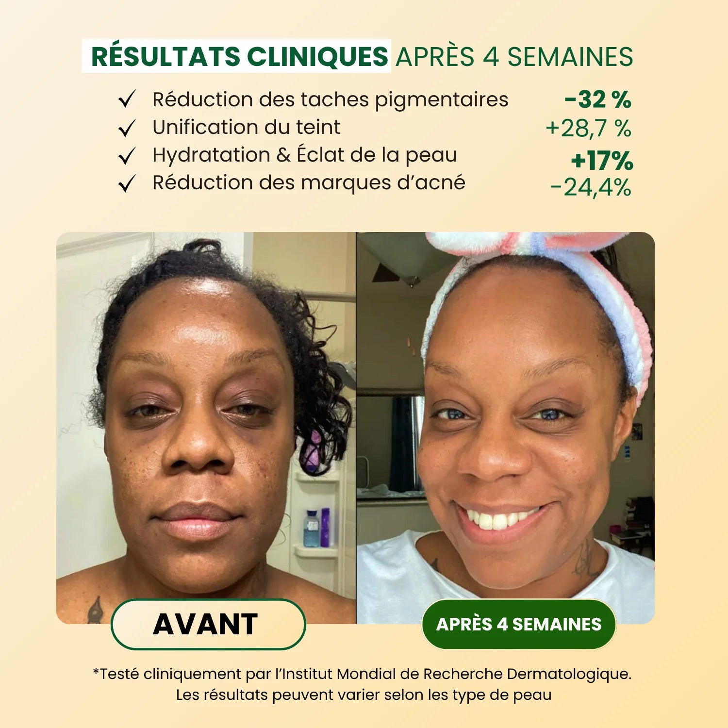 Savon Anti-Taches & Hyperpigmentation au Curcuma (+200g OFFERTS)